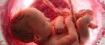 Baby